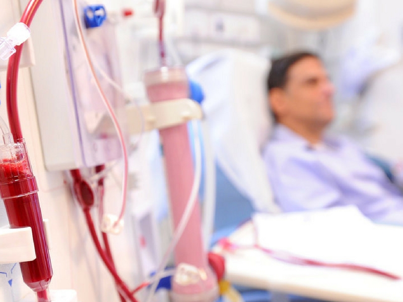 Kidney Disease Patients at Higher Risk For PAD - USA Vascular Centers