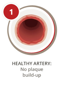Healthy Artery