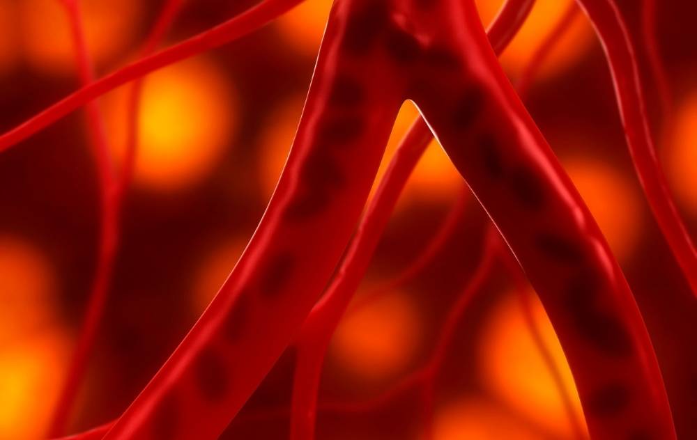 Why Is Peripheral Artery Disease Hereditary USA Vascular Centers