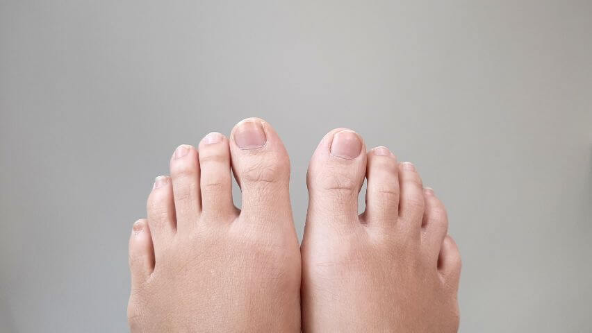 Why Are My Toenails Not Growing | USA Vascular Centers