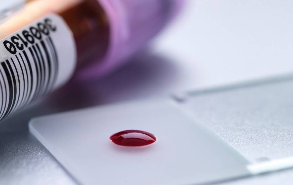 Is There a Blood Test for Vascular Disease? USA Vascular Centers