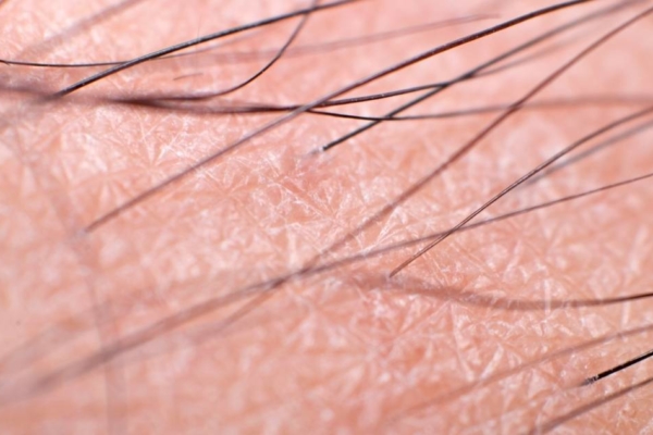 Up close picture of hair and skin on leg