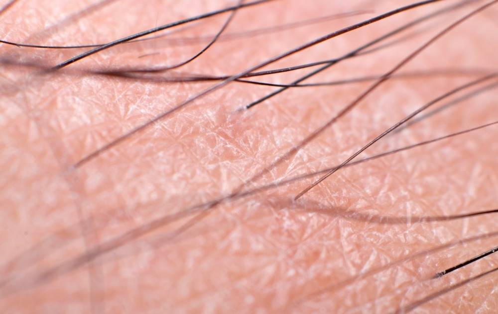 Why Am I Losing Hair On My Legs? | USA Vascular Centers