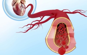 Heart vs artery diagram