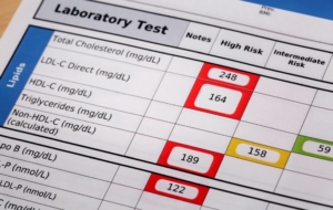 Cholesterol screening lab sheet with results