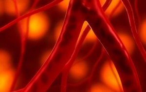 Arterial mapping and genetic vascular diseases