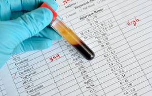 Cholesterol test showing elevated levels on paper