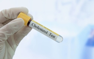 Cholesterol test tube