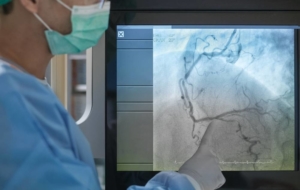 Doctor viewing angiogram live x-ray of arterial system