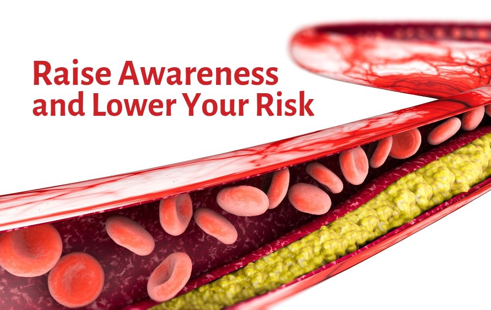 Raise awareness and lower your risk
