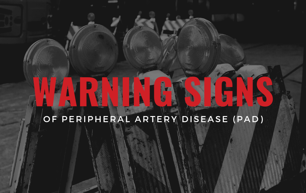 The Warning Signs of PAD