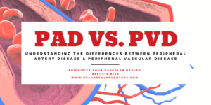 Understanding the Differences Between PAD vs. PVD