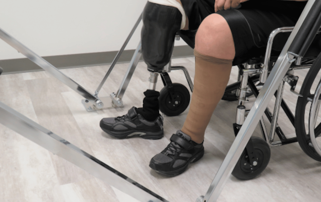 Diabetes-Related Foot & Leg Amputation Risks