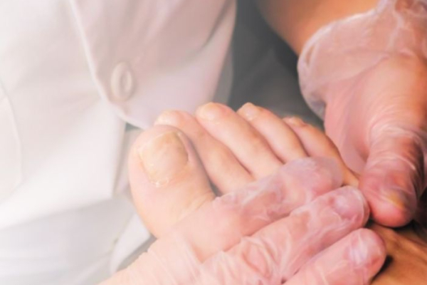 PAD and toenail growth