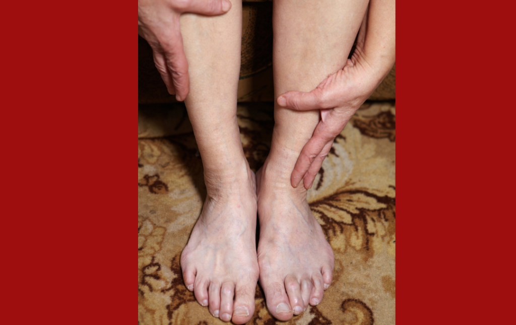 olie prik spejder Hair Loss on Legs: Watch Out for Peripheral Artery Disease