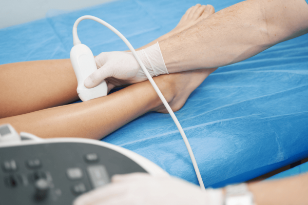 Vascular Ultrasounds