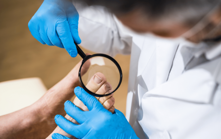 Why Are My Toenails Not Growing?