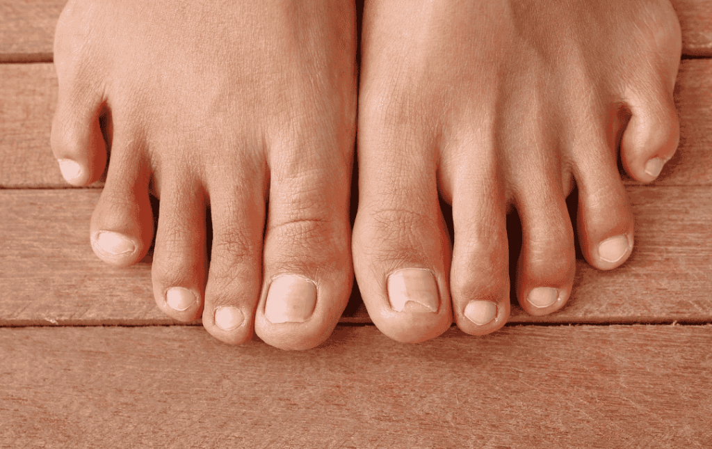 Why Are My Toenails Not Growing?