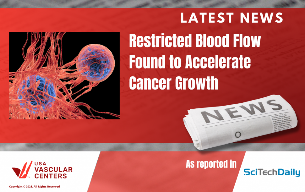 Latest Vasc News_PAD Fuels Cancer Growth