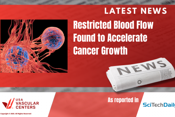 Latest Vasc News_PAD Fuels Cancer Growth