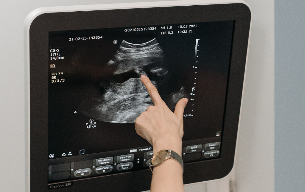 How Is Pad Diangoised