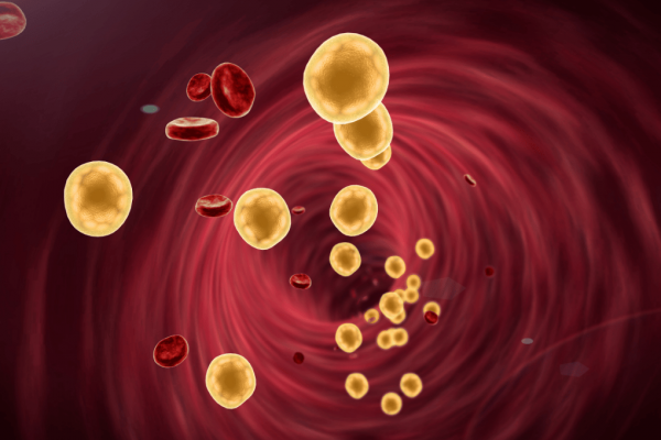 Cholesterol is an important part of your artery health, and that includes your legs