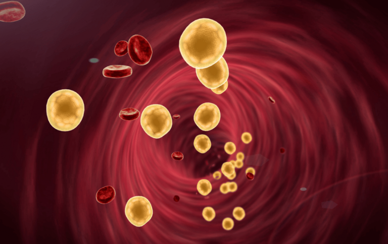 Cholesterol is an important part of your artery health, and that includes your legs