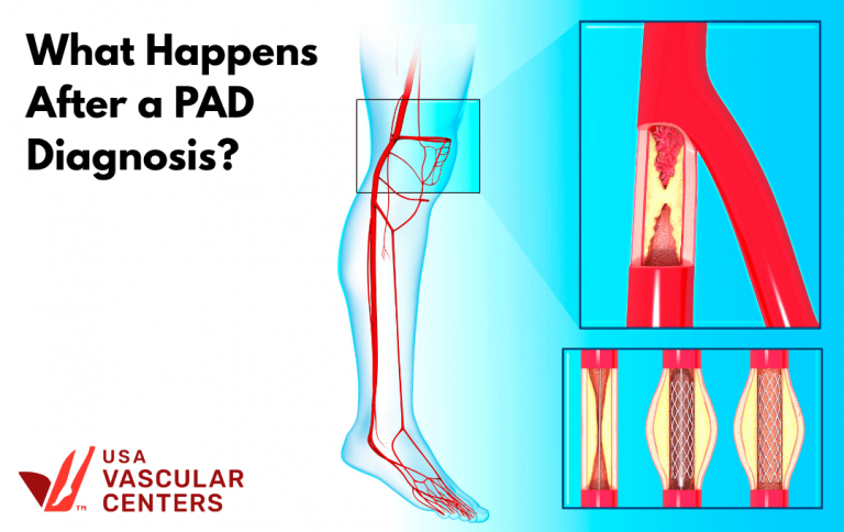 A PAD diagnosis can leave you with several questions. We're here to help.