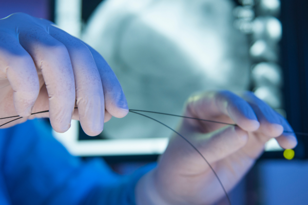 Specialist using catheter wire.
