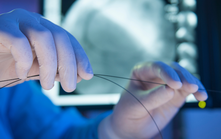 Specialist using catheter wire.